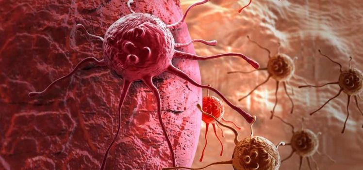 los-nuevos-diagnosticos-de-cancer-aumentan-ano-tras-ano-en-todo-el-mundo
